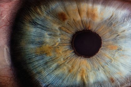 Picture: Создана диагностирующая и прогнозирующая болезни глаз нейросеть