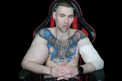 picture: Россиянину с «руками-базуками» предрекли ампутацию