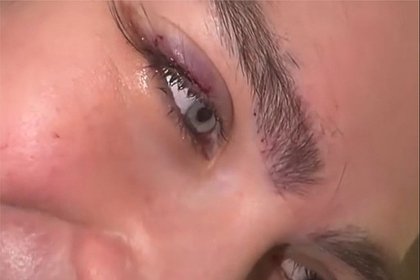 picture: В Сети удивились внешности клиентки после пересадки ресниц